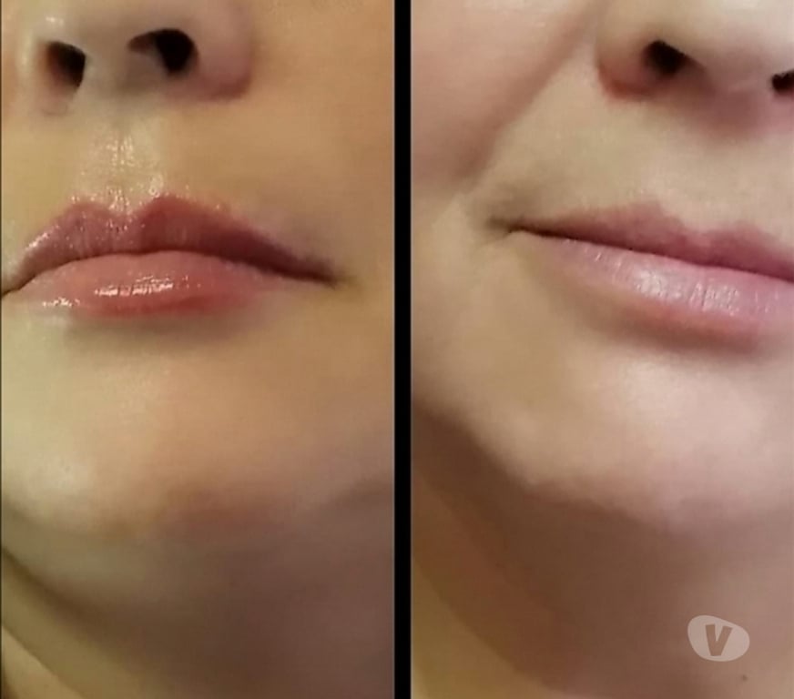 Masajes Santiago La Cisterna - Fotos de Delineado permanente Ojos Labios Cejas ( Micropigmentacion)