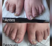 Podologia Pie Sano