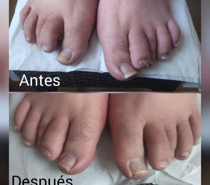  Santiago Santiago - Fotos de Podologia Pie Sano