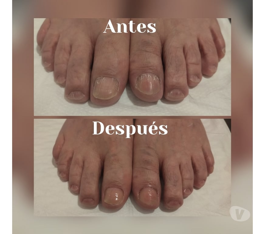 Masajes Santiago Santiago - Fotos de Masoterapia, Podología, Depilación, Biomagnetismo, Reiki