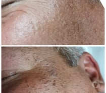 LESIONES CUTÁNEAS SANTIAGO CENTRO